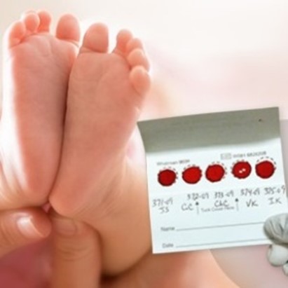 In Gazzetta il decreto Lorenzin sugli screening neonatali. Stanziati 25 milioni di euro a valere sul Fsn 2014/2016
