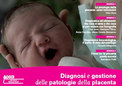 Diagnosi e gestione delle patologie della placenta