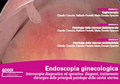 Endoscopia ginecologica