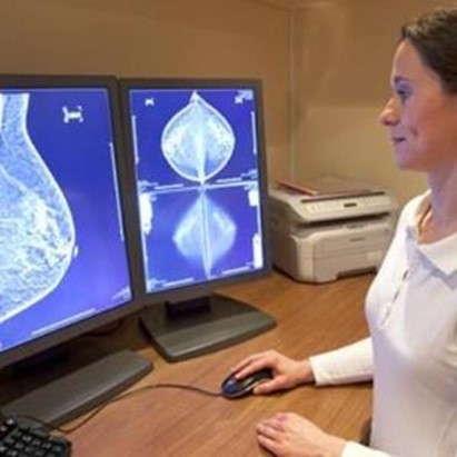 Screening mammografici. Mega studio Usa sui costi/benefici. Diagnosi aumentano ma riduzione malattia è più merito delle cure che non della diagnostica precoce. E poi ci sono i costi delle sovradiagnosi