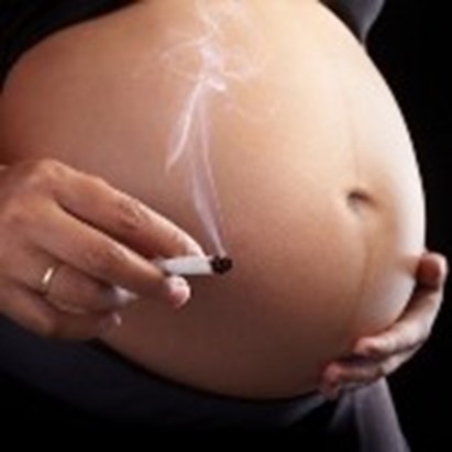 Fumo in gravidanza. Rischio di psoriasi per il feto