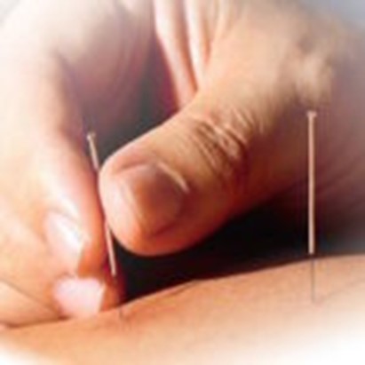 Menopausa. Agopuntura efficace sui sintomi. Lo studio sul Bmj