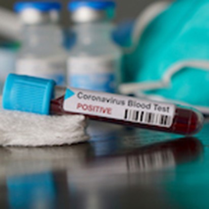 Coronavirus. Inail: “Il contagio del personale sanitario è inquadrato come infortunio sul lavoro”