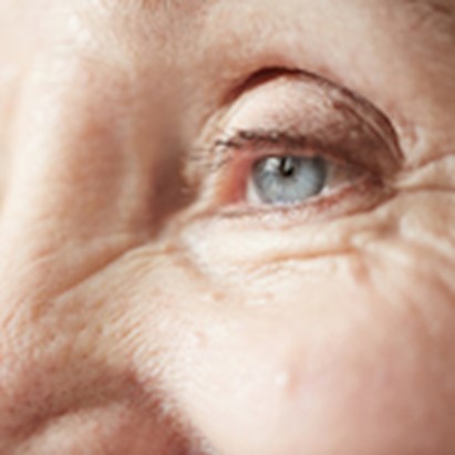 Donne anziane. Problemi di vista favoriscono declino cognitivo