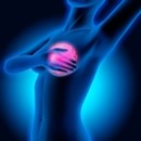 Tumore del seno: l’esercizio fisico migliora la tollerabilità alla radioterapia