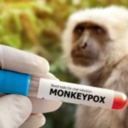 Vaiolo delle scimmie. Commissione Ue preoccupata compra altre 54 mila dosi di vaccino: “Casi raddoppiati nell’ultima settimana”