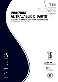 Induzione al travaglio