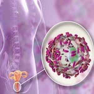 Bacterial vaginosis, bacteria Gardnerella vaginalis