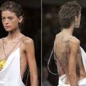 anoressia-e-moda