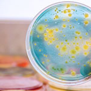 Bacterial colonies culture