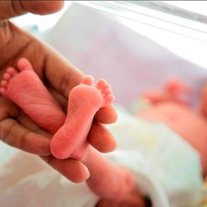 bambino-prematuro-300