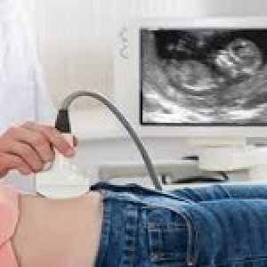 cassazione-doppio-risarcimento