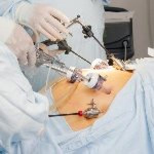 chirurgia-bariatrica