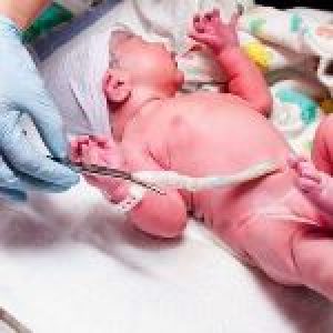 cordone-ombelicale-696x435