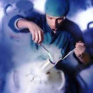 crioconservazione-embrione2