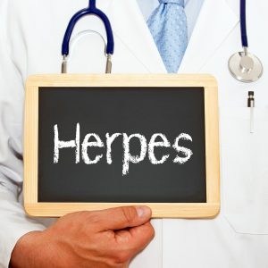 herpes