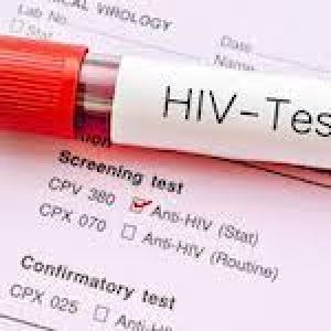hiv-test-77