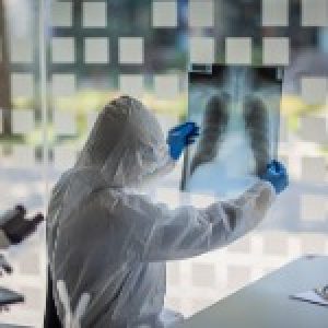 polmoni-lastra-coronavirus