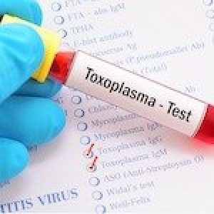 toxoplasmosi