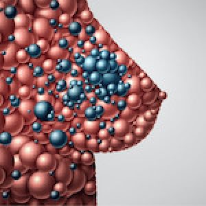 tumore-seno-metastatico-5