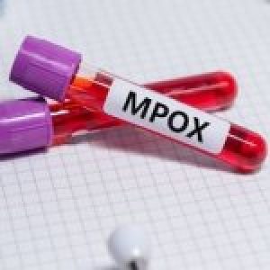 vaiolo-delle-scimmie