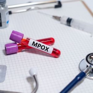 vaiolo-delle-scimmie